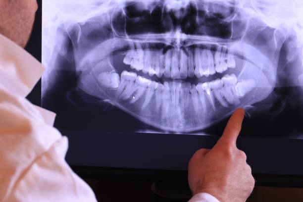 Best Emergency Root Canal Therapy in Genesee, CO